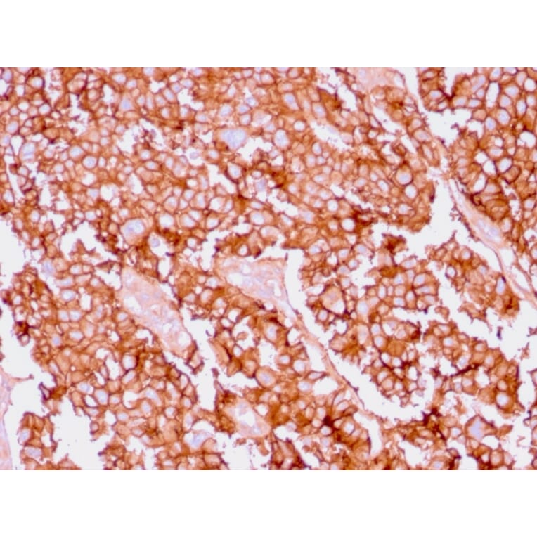 Immunohistochemistry - Anti-EpCAM Antibody [EGP40/1556R] (A249265) - Antibodies.com