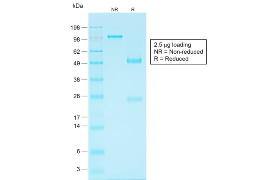 SDS-PAGE - Anti-EpCAM Antibody [EGP40/1556R] (A249265) - Antibodies.com