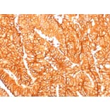 Immunohistochemistry - Anti-EpCAM Antibody [EGP40/1556R] (A249265) - Antibodies.com