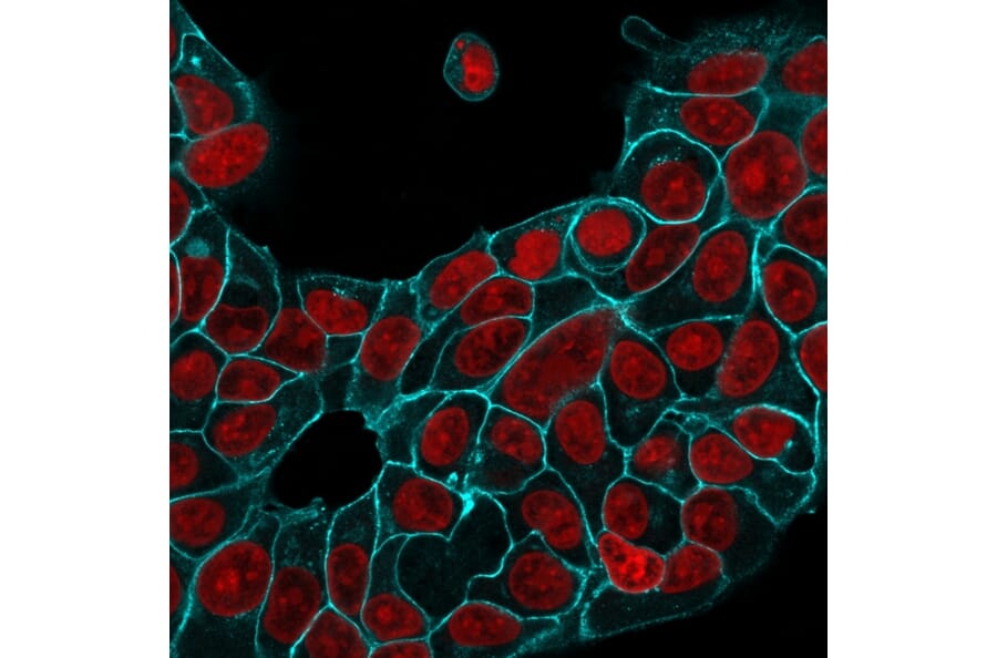 Immunofluorescence - Anti-EpCAM Antibody [EGP40/1556R] (A249265) - Antibodies.com