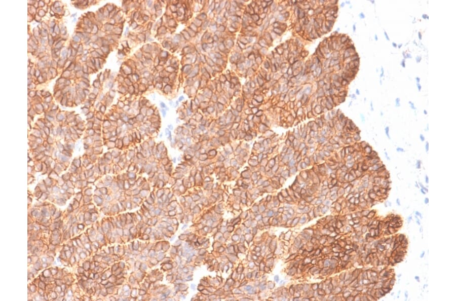 Immunohistochemistry - Anti-EpCAM Antibody [EGP40/2041R] (A249265) - Antibodies.com