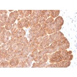Immunohistochemistry - Anti-EpCAM Antibody [EGP40/2041R] (A249265) - Antibodies.com