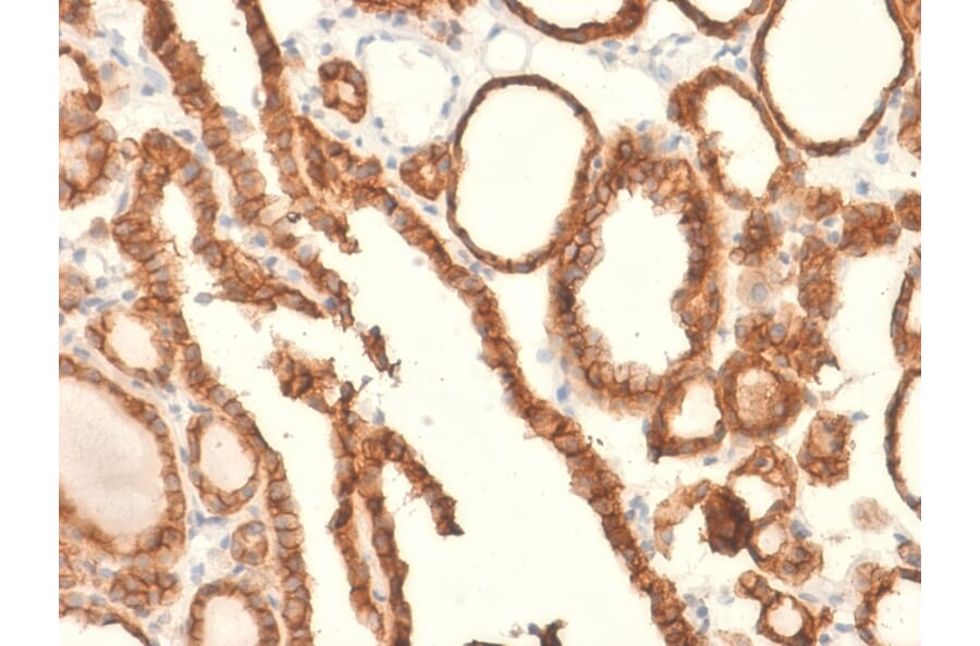 Immunohistochemistry - Anti-EpCAM Antibody [EGP40/2041R] (A249266) - Antibodies.com