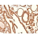 Immunohistochemistry - Anti-EpCAM Antibody [EGP40/2041R] (A249266) - Antibodies.com