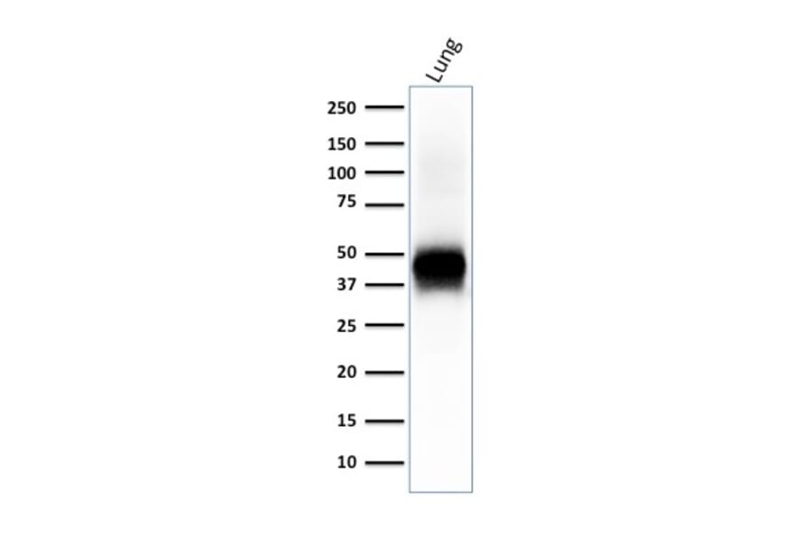 Western Blot - Anti-EpCAM Antibody [EGP40/2041R] (A249266) - Antibodies.com