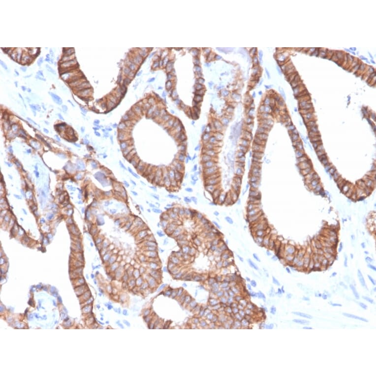 Immunohistochemistry - Anti-EpCAM Antibody [EGP40/2571R] (A249267) - Antibodies.com