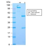 SDS-PAGE - Anti-EpCAM Antibody [EGP40/2571R] (A249267) - Antibodies.com