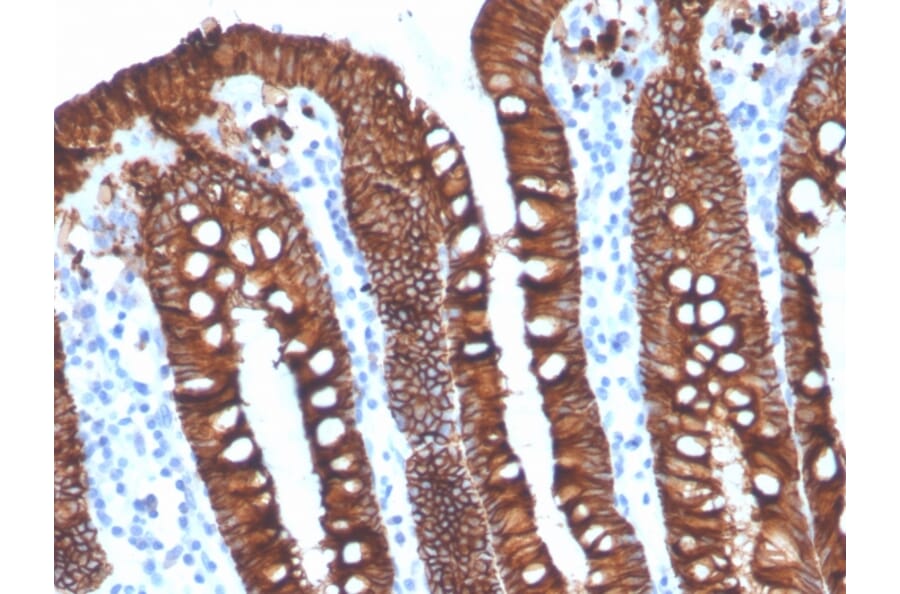 Immunohistochemistry - Anti-EpCAM Antibody [EGP40/4546R] (A249268) - Antibodies.com