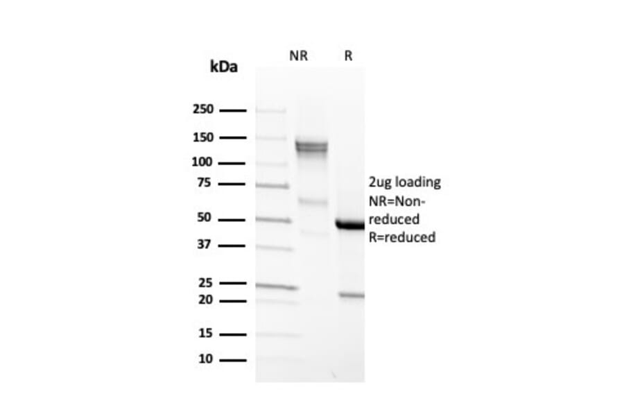 SDS-PAGE - Anti-EpCAM Antibody [EGP40/4546R] (A249268) - Antibodies.com