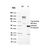 SDS-PAGE - Anti-EpCAM Antibody [EGP40/4546R] (A249268) - Antibodies.com