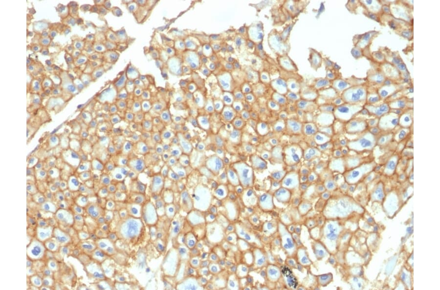 Immunohistochemistry - Anti-EpCAM Antibody (A249269) - Antibodies.com