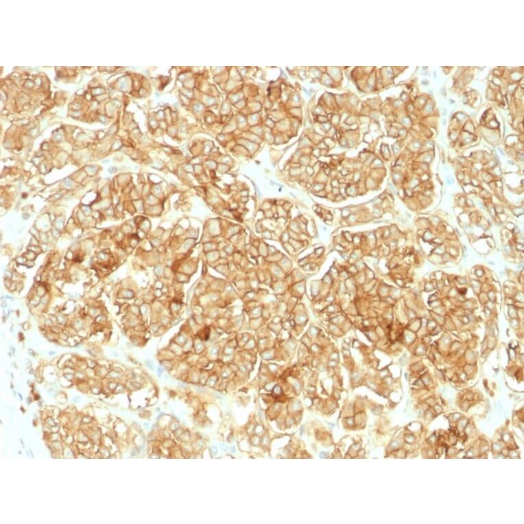 Immunohistochemistry - Anti-EpCAM Antibody (A249268) - Antibodies.com