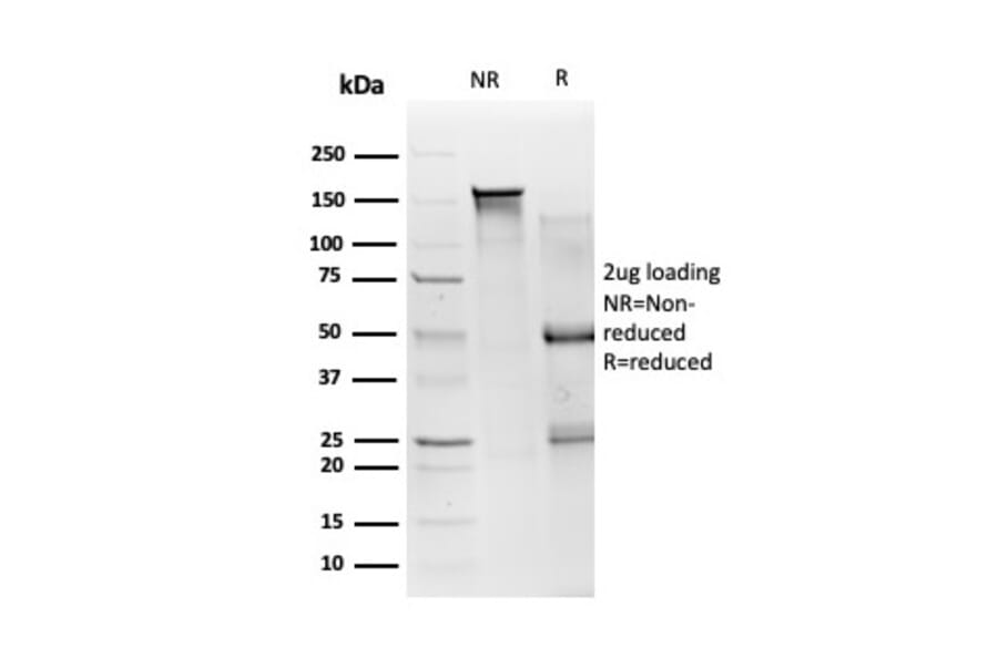 SDS-PAGE - Anti-SMAD3 Antibody [PCRP-SMAD3-1A2] (A249270) - Antibodies.com