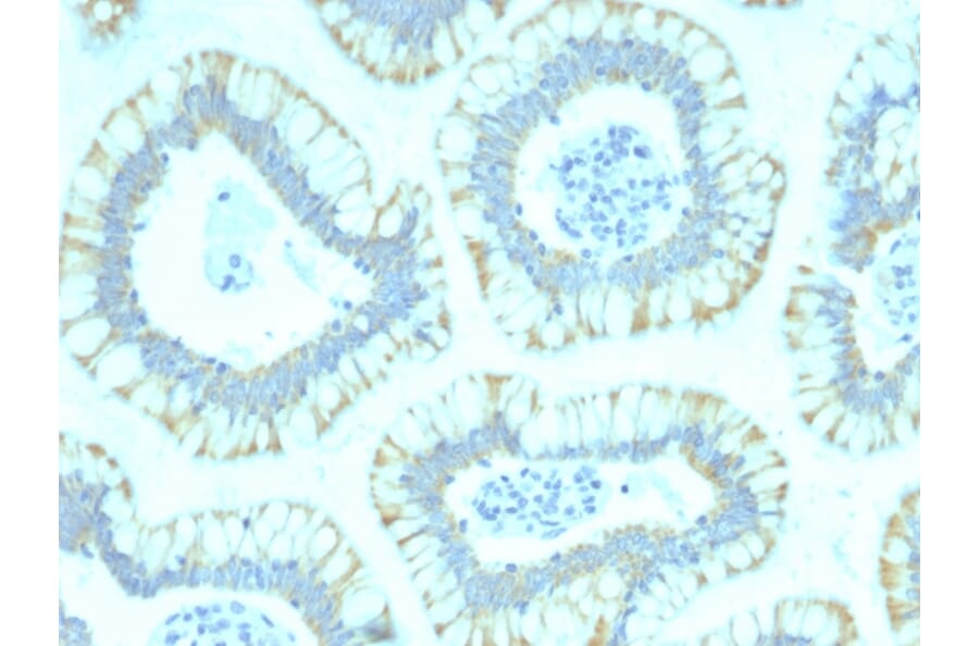 Immunohistochemistry - Anti-SMAD4 Antibody [SMAD4/2440] (A249271) - Antibodies.com