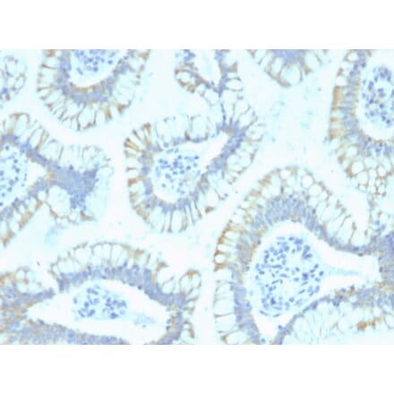Immunohistochemistry - Anti-SMAD4 Antibody [SPM448] (A249271) - Antibodies.com