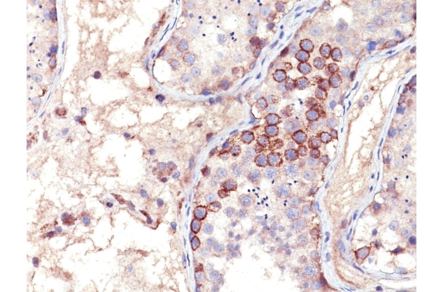 Immunohistochemistry - Anti-MAGE 1 Antibody [MA454] (A249273) - Antibodies.com