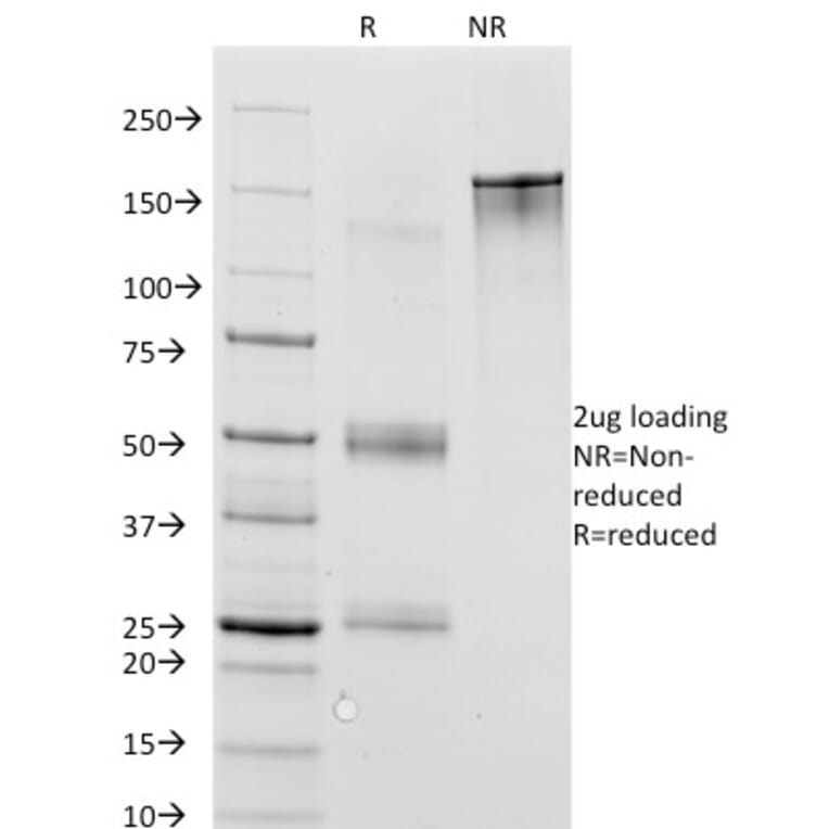 SDS-PAGE - Anti-MAGE 1 Antibody [MA454] (A249274) - Antibodies.com