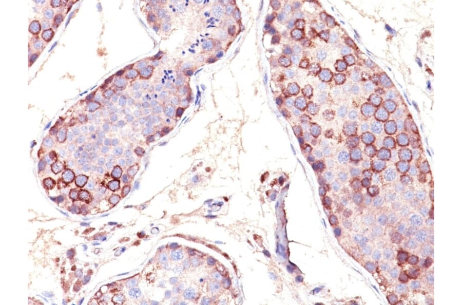 Immunohistochemistry - Anti-MAGE 1 Antibody [SPM282] (A249274) - Antibodies.com