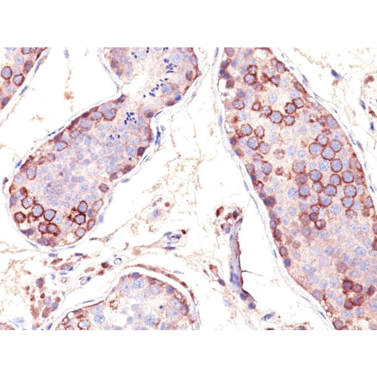 Immunohistochemistry - Anti-MAGE 1 Antibody [SPM282] (A249274) - Antibodies.com