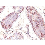 Immunohistochemistry - Anti-MAGE 1 Antibody [SPM282] (A249274) - Antibodies.com