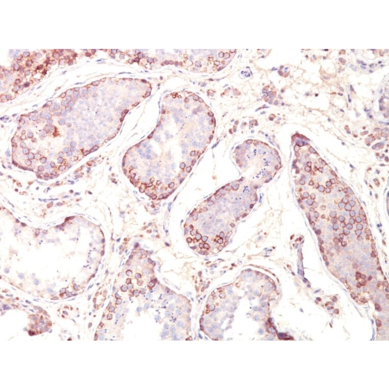 Immunohistochemistry - Anti-MAGE 1 Antibody [MZ2E/838] (A249275) - Antibodies.com