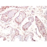 Immunohistochemistry - Anti-MAGE 1 Antibody [MZ2E/838] (A249275) - Antibodies.com