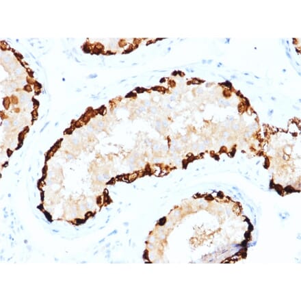 Immunohistochemistry - Anti-MAGEA4 Antibody [CPTC-MAGEA4-1] (A249277) - Antibodies.com