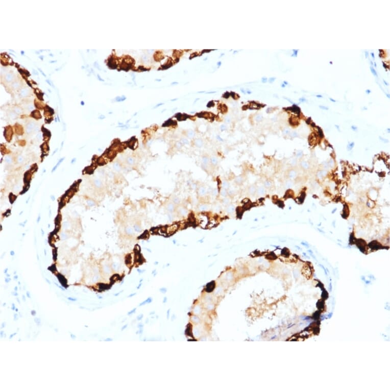 Immunohistochemistry - Anti-MAGEA4 Antibody [CPTC-MAGEA4-1] (A249277) - Antibodies.com