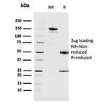 SDS-PAGE - Anti-MAGEA4 Antibody [CPTC-MAGEA4-1] (A249277) - Antibodies.com