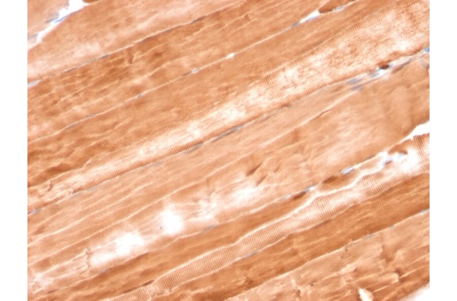 Immunohistochemistry - Anti-Myoglobin Antibody [MB/2105] (A249278) - Antibodies.com