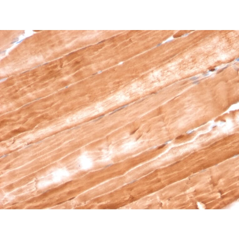 Immunohistochemistry - Anti-Myoglobin Antibody [MB/2105] (A249278) - Antibodies.com