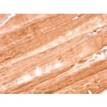 Immunohistochemistry - Anti-Myoglobin Antibody [MB/2105] (A249278) - Antibodies.com