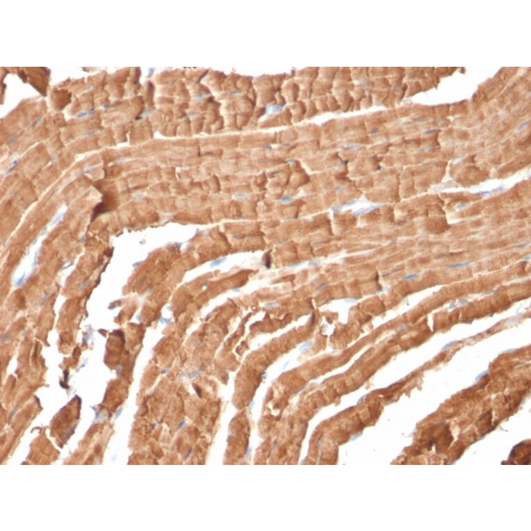 Immunohistochemistry - Anti-Myoglobin Antibody [MB/2105] (A249277) - Antibodies.com