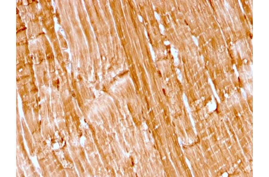 Immunohistochemistry - Anti-Myoglobin Antibody [rMB/2105] (A249278) - Antibodies.com