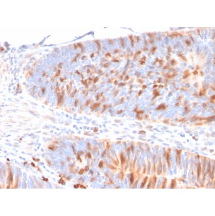 Immunohistochemistry - Anti-MBD1 Antibody [CPTC-MBD1-1] (A249279) - Antibodies.com