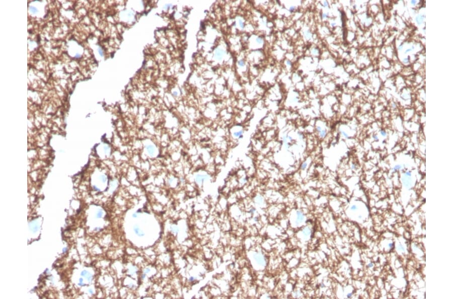 Immunohistochemistry - Anti-Myelin Basic Protein Antibody [MBP/4271] (A249280) - Antibodies.com