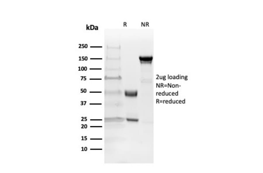 SDS-PAGE - Anti-Myelin Basic Protein Antibody [MBP/4271] (A249281) - Antibodies.com