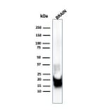 Western Blot - Anti-Myelin Basic Protein Antibody [MBP/4271] (A249281) - Antibodies.com