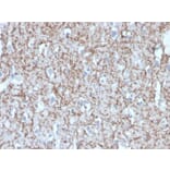 Immunohistochemistry - Anti-Myelin Basic Protein Antibody [MBP/4272] (A249282) - Antibodies.com