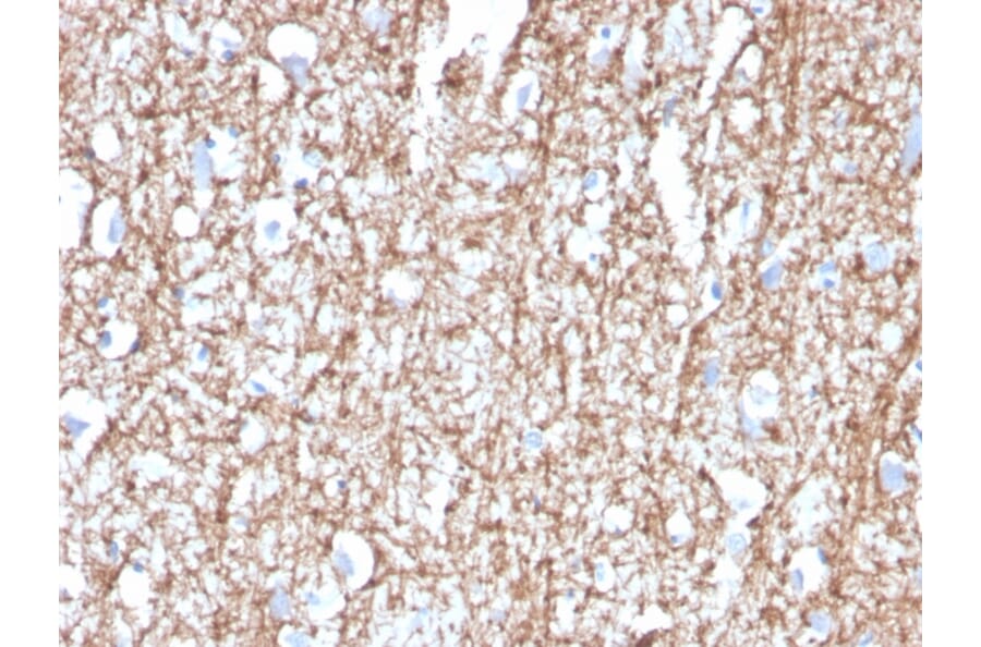 Immunohistochemistry - Anti-Myelin Basic Protein Antibody [MBP/4272] (A249281) - Antibodies.com