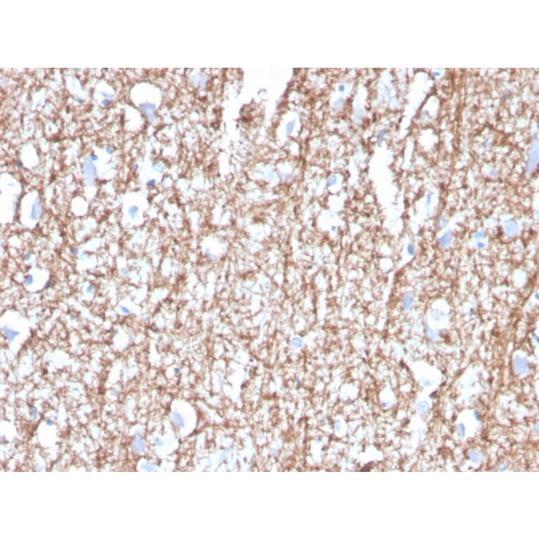 Immunohistochemistry - Anti-Myelin Basic Protein Antibody [MBP/4272] (A249281) - Antibodies.com