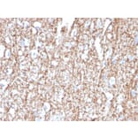 Immunohistochemistry - Anti-Myelin Basic Protein Antibody [MBP/4272] (A249281) - Antibodies.com