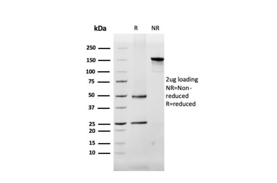 SDS-PAGE - Anti-Myelin Basic Protein Antibody [MBP/4272] (A249282) - Antibodies.com