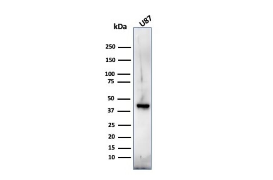 Western Blot - Anti-Myelin Basic Protein Antibody [MBP/4272] (A249282) - Antibodies.com