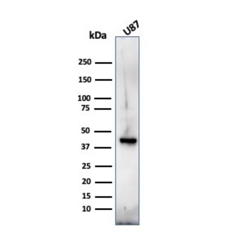 Western Blot - Anti-Myelin Basic Protein Antibody [MBP/4272] (A249282) - Antibodies.com
