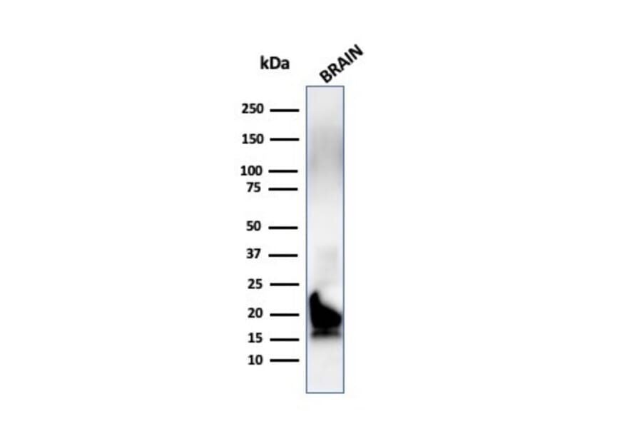Western Blot - Anti-Myelin Basic Protein Antibody [MBP/4272] (A249282) - Antibodies.com