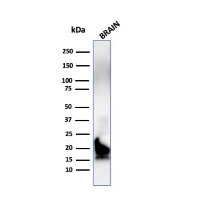 Western Blot - Anti-Myelin Basic Protein Antibody [MBP/4272] (A249282) - Antibodies.com