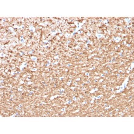 Immunohistochemistry - Anti-Myelin Basic Protein (phospho Thr98) Antibody [MBP/4276] (A249283) - Antibodies.com