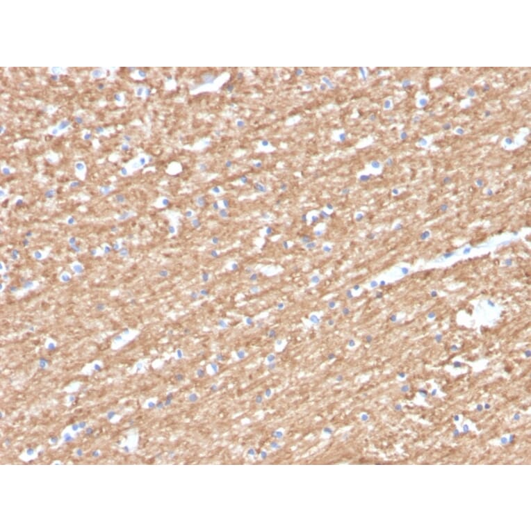 Immunohistochemistry - Anti-Myelin Basic Protein (phospho Thr98) Antibody [MBP/4276] (A249282) - Antibodies.com