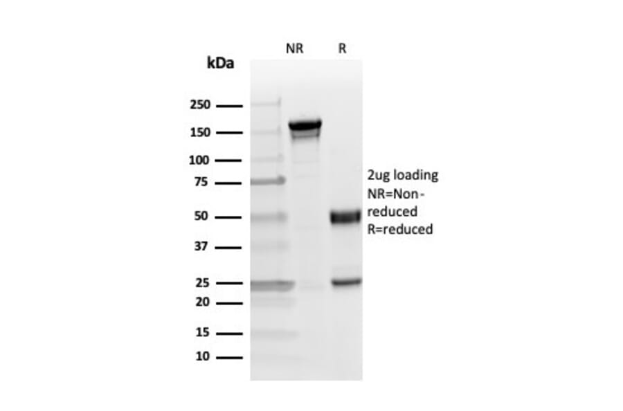 SDS-PAGE - Anti-Myelin Basic Protein (phospho Thr98) Antibody [MBP/4276] (A249283) - Antibodies.com